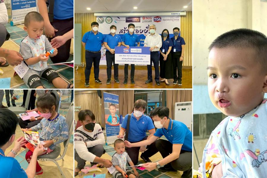 TOA ร่วมสร้างรอยยิ้ม ช่วยเหลือเด็กภาวะปากแหว่ง เพดานโหว่ จ.แม่ฮ่องสอน TOA ร่วมสร้างรอยยิ้ม ช่วยเหลือเด็กภาวะปากแหว่ง เพดานโหว่ จ.แม่ฮ่องสอน