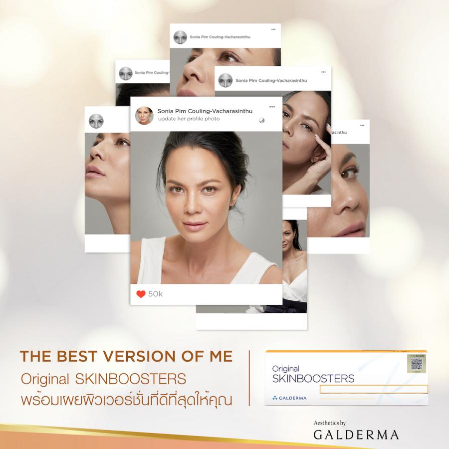 Galderma ตอกย้ำความเป็นผู้นำด้านนวัตกรรมความงาม  ปล่อยแคมเปญ “THE BEST VERSION OF ME” พร้อมเผยผิวเวอร์ชั่นที่ดีที่สุดให้คุณ  โดย Original SKINBOOSTERS  นวัตกรรมที่ช่วยบูสต์ผิวให้กระจ่างใสชุ่มชื้น เปล่งประกายจากภายในสู่ภายนอก