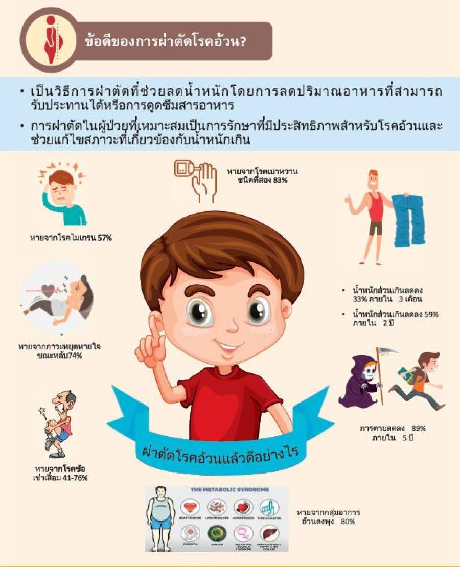         การรักษาโรคอ้วนด้วยวิธีการผ่าตัด นพ.เสฐียรพงษ์ จันทวิบูลย์  ศัลยแพทย์ผู้เชี่ยวชาญผ่าตัดผ่านกล้องและการผ่าตัด ลดน้ำหนัก คลินิกโรคอ้วน โรงพยาบาลราชวิถี  