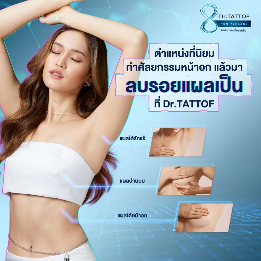 Dr.TATTOF ดันเทคโนโลยีเลเซอร์ลบรอยแผลเป็น ชูความเป็นศูนย์เลเซอร์ครบวงจร