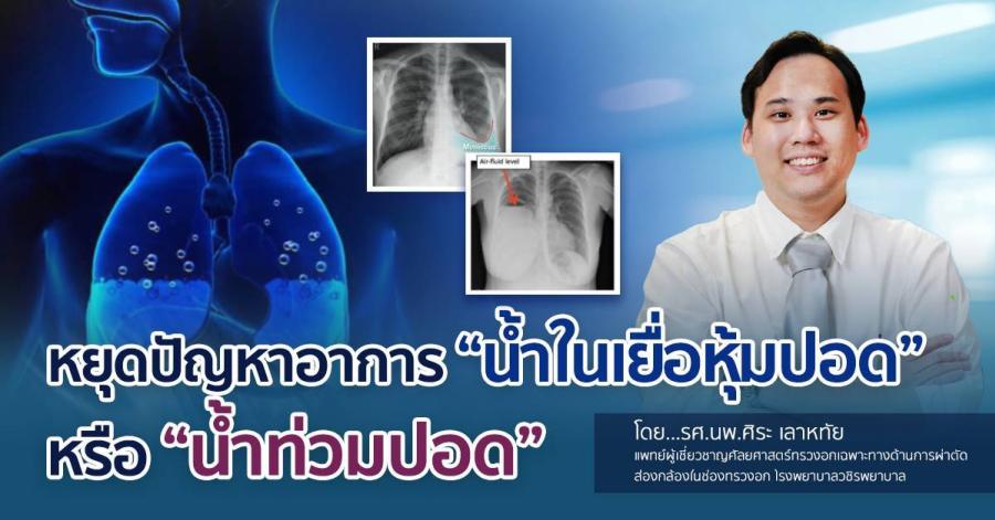 หยุดปัญหาอาการ “น้ำในเยื่อหุ้มปอด” หรือ “น้ำท่วมปอด” โดย รศ.นพ.ศิระ เลาหทัย แพทย์ผู้เชี่ยวชาญศัลยศาสตร์ ทรวงอกเฉพาะทางด้านการผ่าตัดส่องกล้องในช่องทรวงอก โรงพยาบาลวชิรพยาบาล หยุดปัญหาอาการ “น้ำในเยื่อหุ้มปอด” หรือ “น้ำท่วมปอด” โดย รศ.นพ.ศิระ เลาหทัย แพทย์ผู้เชี่ยวชาญศัลยศาสตร์ ทรวงอกเฉพาะทางด้านการผ่าตัดส่องกล้องในช่องทรวงอก โรงพยาบาลวชิรพยาบาล